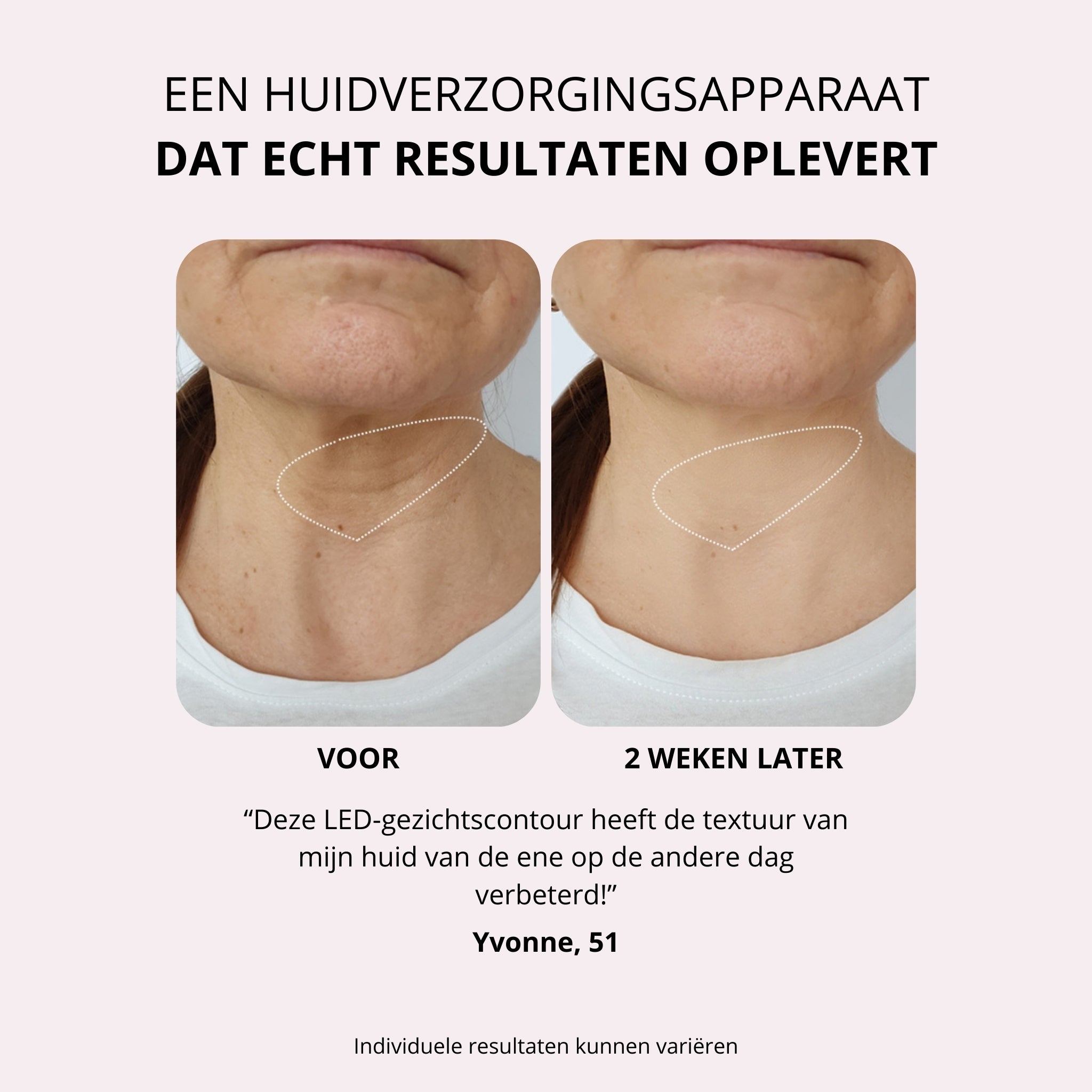 V‑Neck Revive