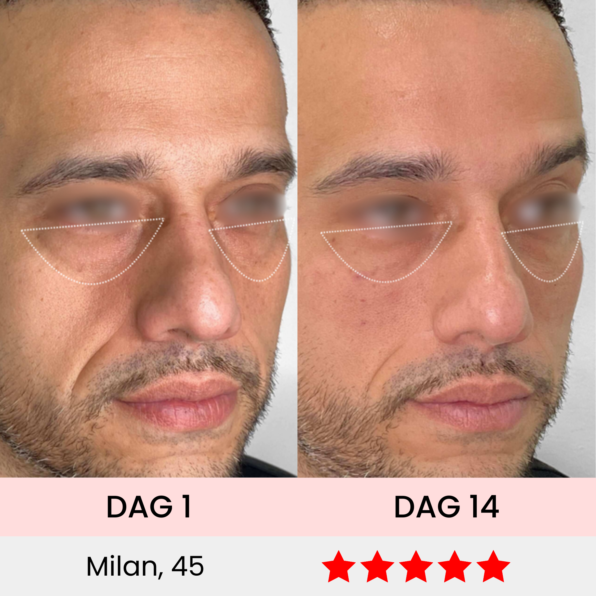 EyeSculpt Pro