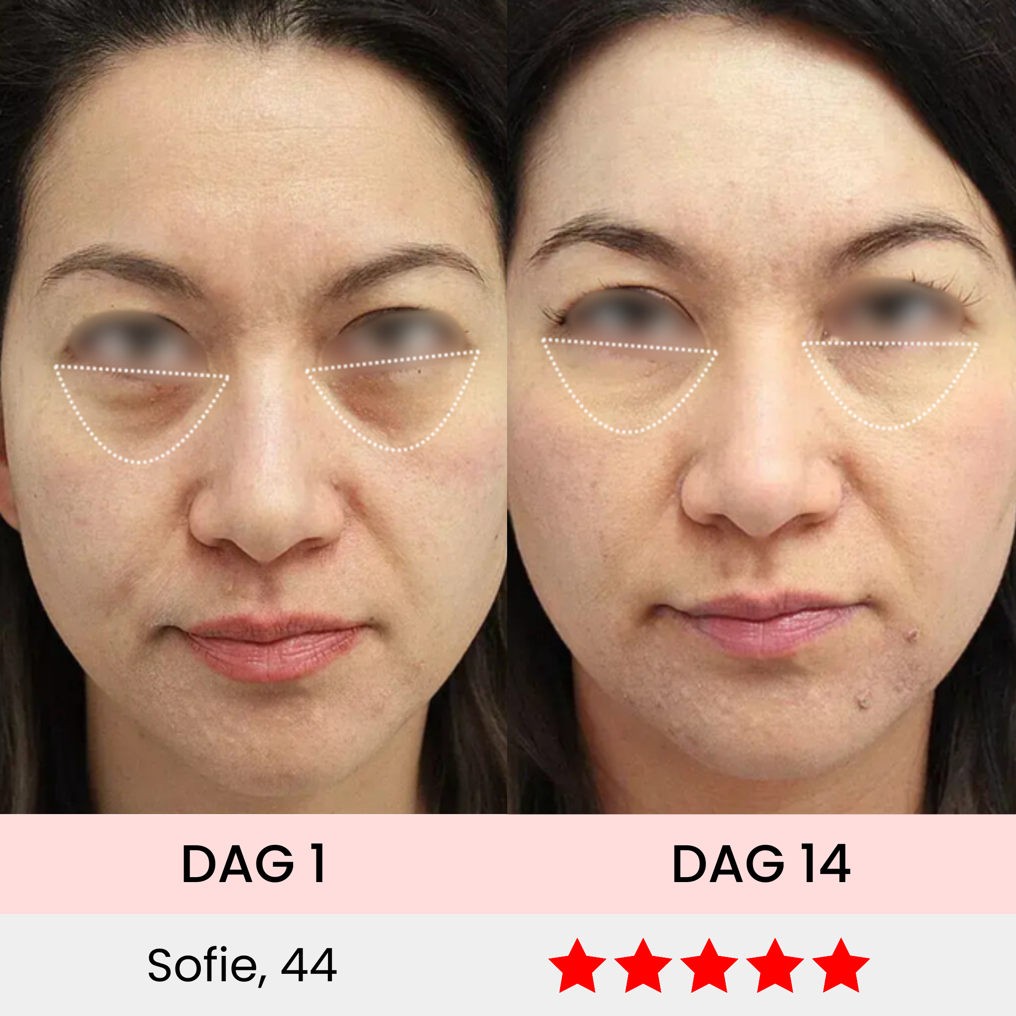 EyeSculpt Pro